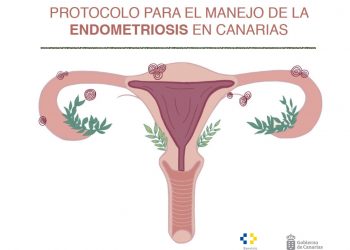 Sanidad registra a más de 12.000 mujeres diagnosticadas de endometriosis en Canarias