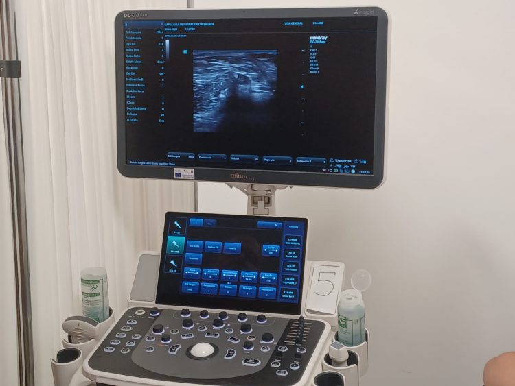 Sanidad refuerza la capacidad diagnóstica de los centros de salud con el impulso de la ecografía clínica